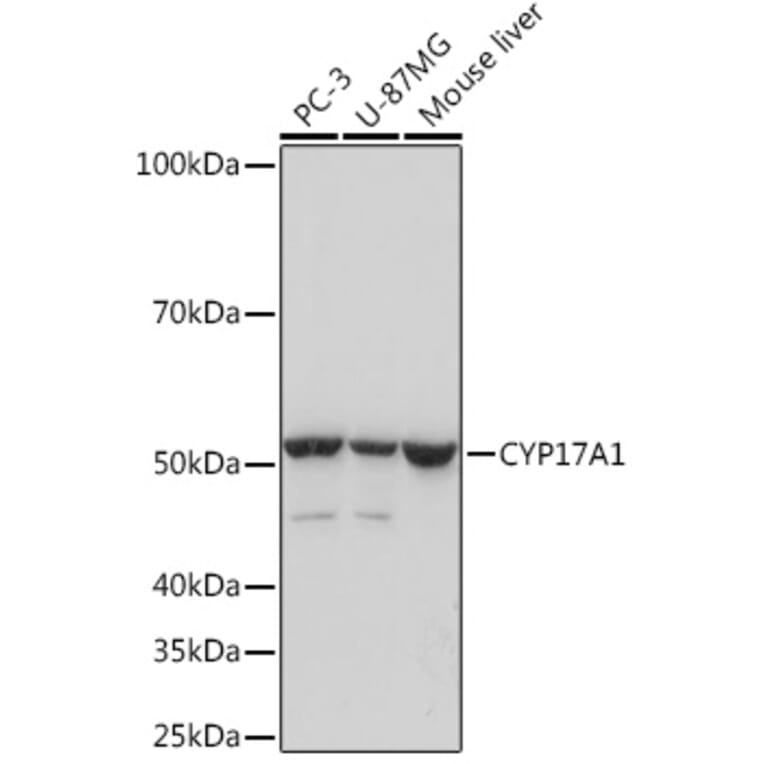 Western Blot - Anti-Cytochrome P450 17A1/CYP17A1 Antibody [ARC1257] (A308923) - Antibodies.com