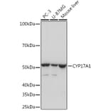 Western Blot - Anti-Cytochrome P450 17A1/CYP17A1 Antibody [ARC1257] (A308923) - Antibodies.com