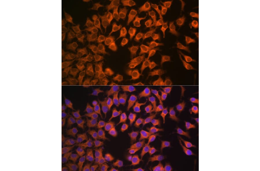 Immunofluorescence - Anti-Cytochrome P450 17A1/CYP17A1 Antibody [ARC1257] (A308923) - Antibodies.com