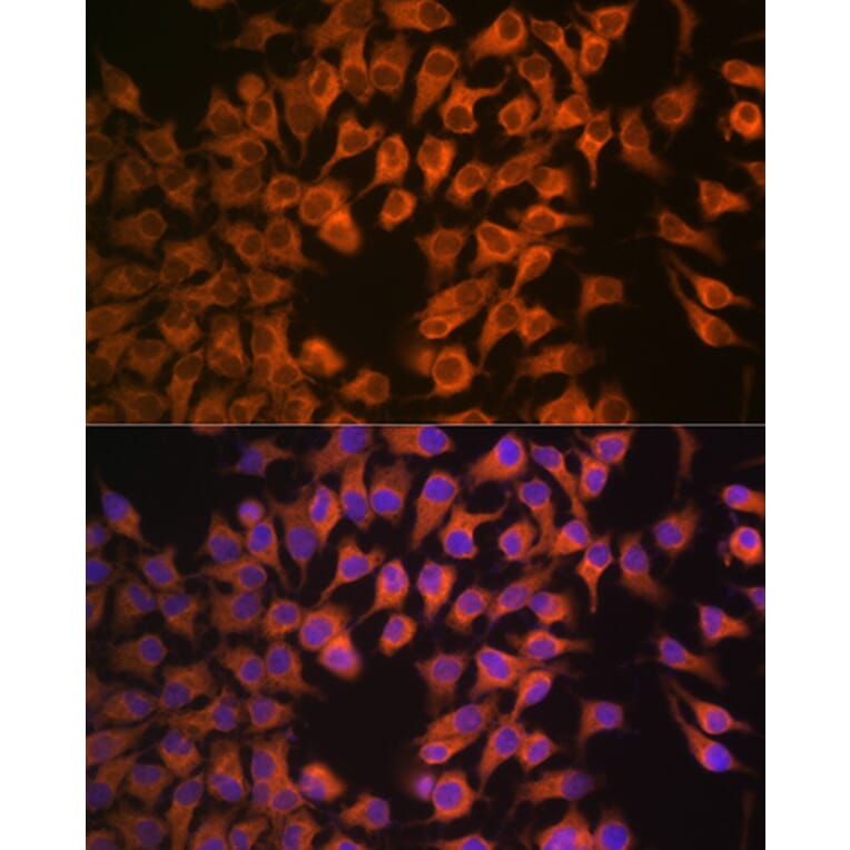 Immunofluorescence - Anti-Cytochrome P450 17A1/CYP17A1 Antibody [ARC1257] (A308923) - Antibodies.com