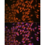 Immunofluorescence - Anti-Cytochrome P450 17A1/CYP17A1 Antibody [ARC1257] (A308923) - Antibodies.com