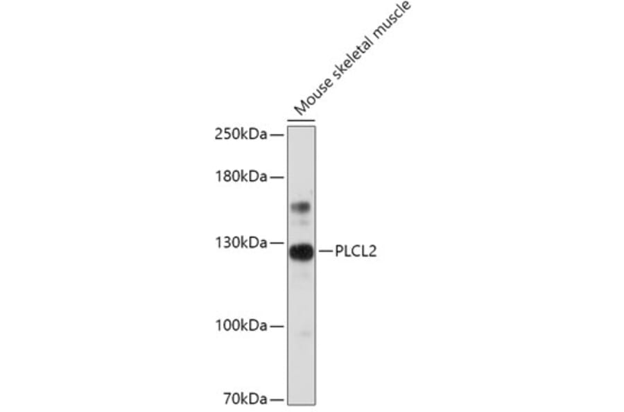 Western Blot - Anti-PLCL2 Antibody (A308924) - Antibodies.com