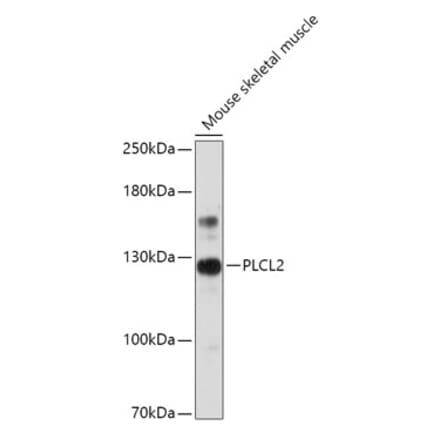 Western Blot - Anti-PLCL2 Antibody (A308924) - Antibodies.com