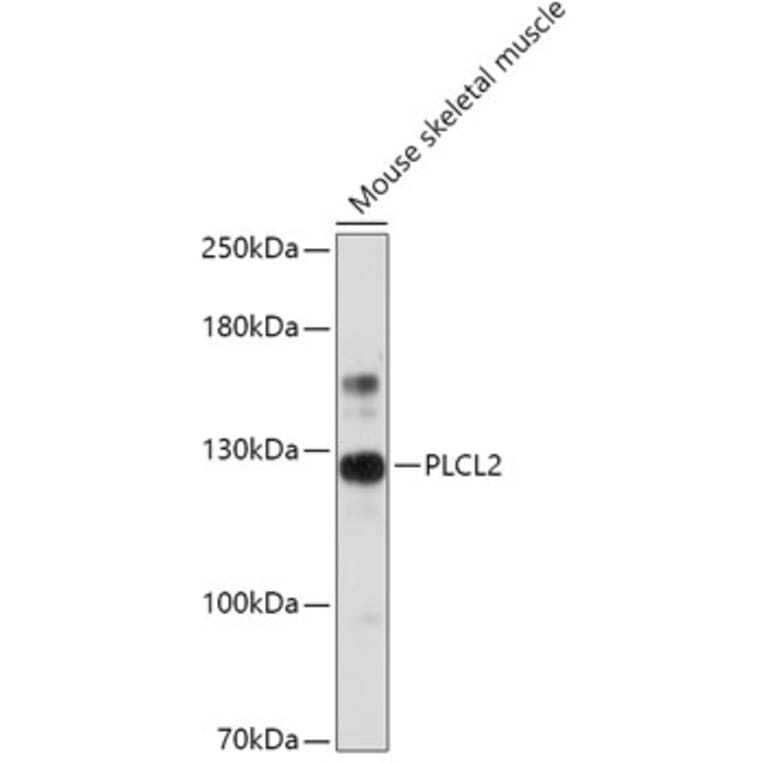 Western Blot - Anti-PLCL2 Antibody (A308924) - Antibodies.com