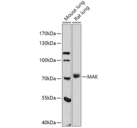 Western Blot - Anti-MAK Antibody (A308925) - Antibodies.com