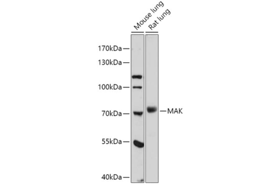 Western Blot - Anti-MAK Antibody (A308925) - Antibodies.com