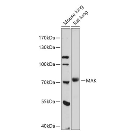 Western Blot - Anti-MAK Antibody (A308925) - Antibodies.com