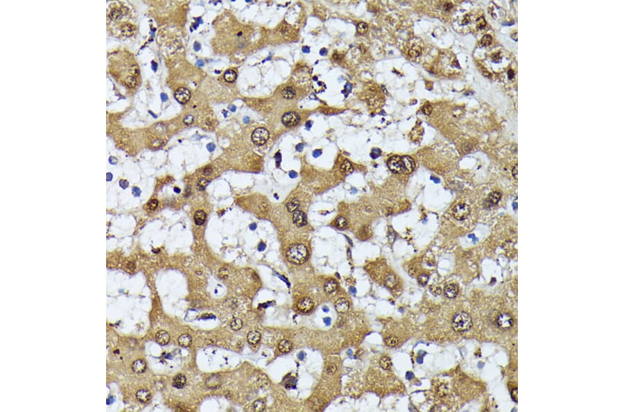 Immunohistochemistry - Anti-MAK Antibody (A308925) - Antibodies.com