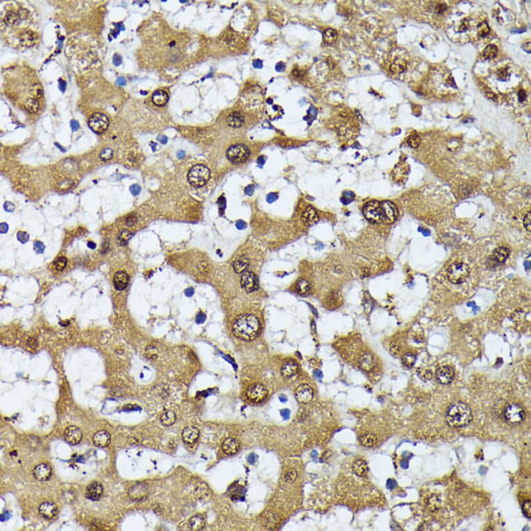 Immunohistochemistry - Anti-MAK Antibody (A308925) - Antibodies.com