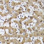 Immunohistochemistry - Anti-MAK Antibody (A308925) - Antibodies.com