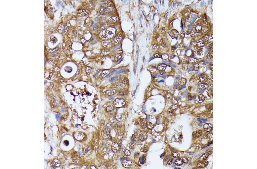 Immunohistochemistry - Anti-MAK Antibody (A308925) - Antibodies.com
