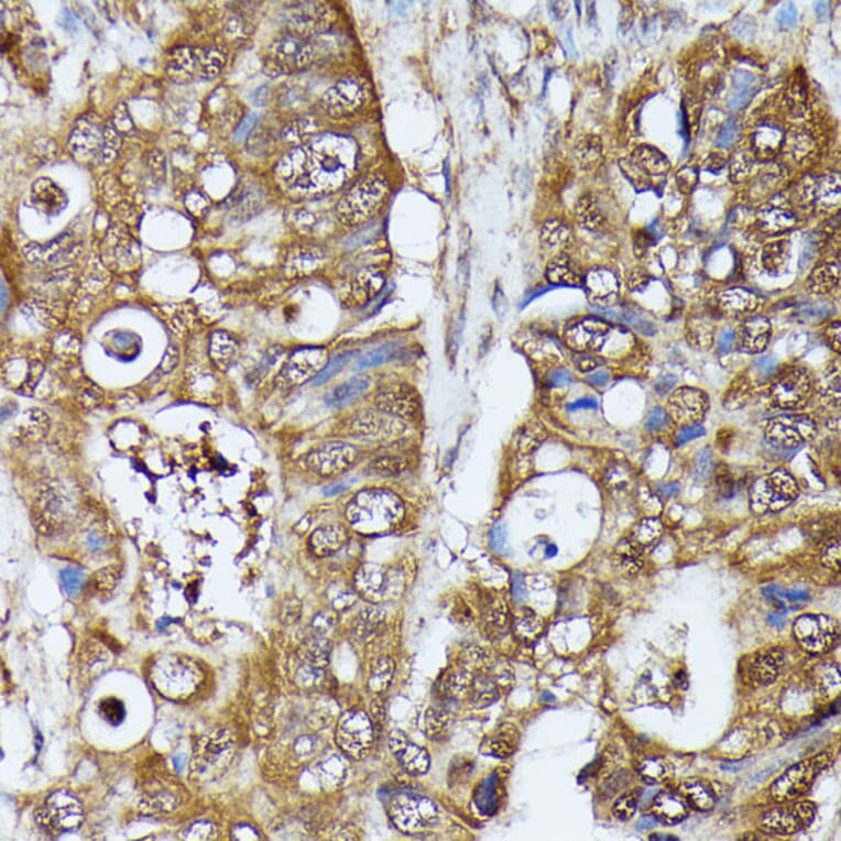 Immunohistochemistry - Anti-MAK Antibody (A308925) - Antibodies.com