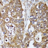Immunohistochemistry - Anti-MAK Antibody (A308925) - Antibodies.com
