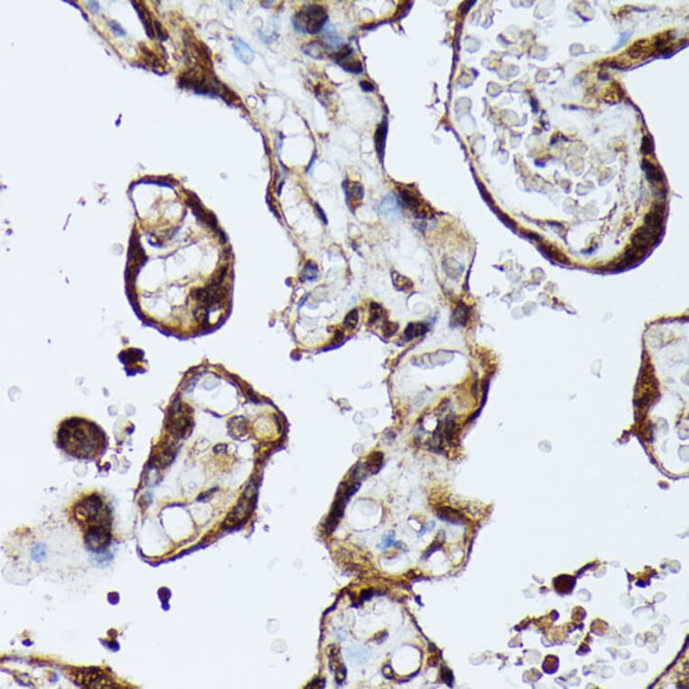 Immunohistochemistry - Anti-MAK Antibody (A308925) - Antibodies.com