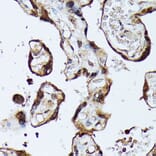 Immunohistochemistry - Anti-MAK Antibody (A308925) - Antibodies.com