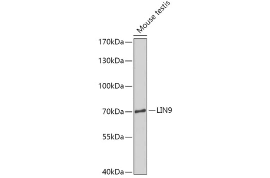 Western Blot - Anti-LIN9/TGS Antibody (A308926) - Antibodies.com
