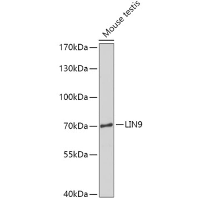 Western Blot - Anti-LIN9/TGS Antibody (A308926) - Antibodies.com