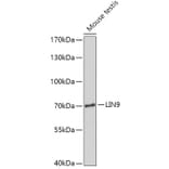 Western Blot - Anti-LIN9/TGS Antibody (A308926) - Antibodies.com