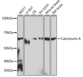 Western Blot - Anti-Calcineurin A Antibody [ARC0970] (A308927) - Antibodies.com
