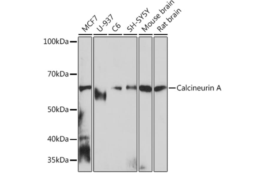 Western Blot - Anti-Calcineurin A Antibody [ARC0970] (A308927) - Antibodies.com