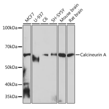 Western Blot - Anti-Calcineurin A Antibody [ARC0970] (A308927) - Antibodies.com