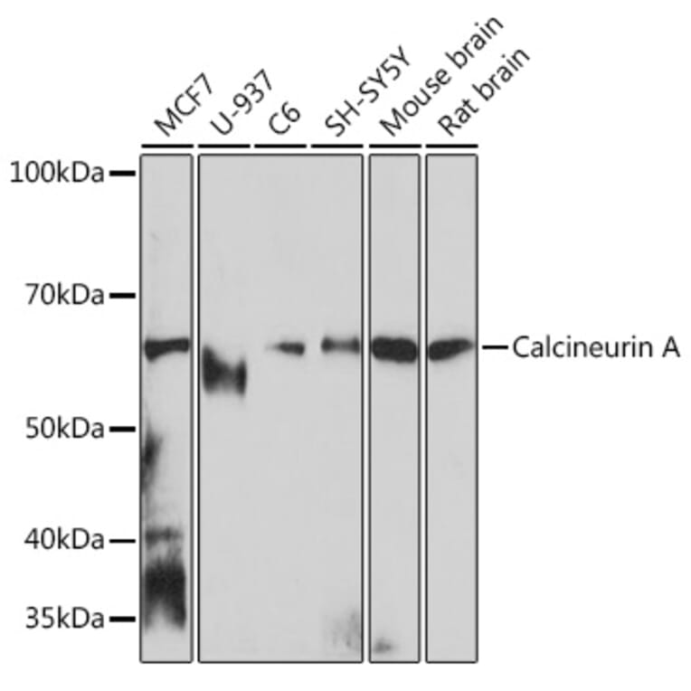 Western Blot - Anti-Calcineurin A Antibody [ARC0970] (A308927) - Antibodies.com