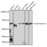 Western Blot - Anti-Calcineurin A Antibody [ARC0970] (A308927) - Antibodies.com
