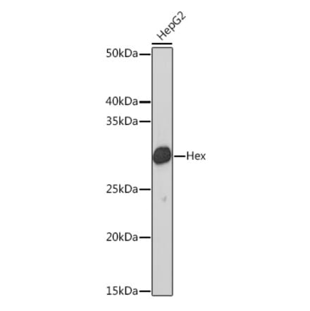 Western Blot - Anti-Hex Antibody [ARC2232] (A308928) - Antibodies.com