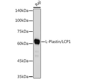 Western Blot - Anti-Plastin L Antibody [ARC2689] (A308929) - Antibodies.com