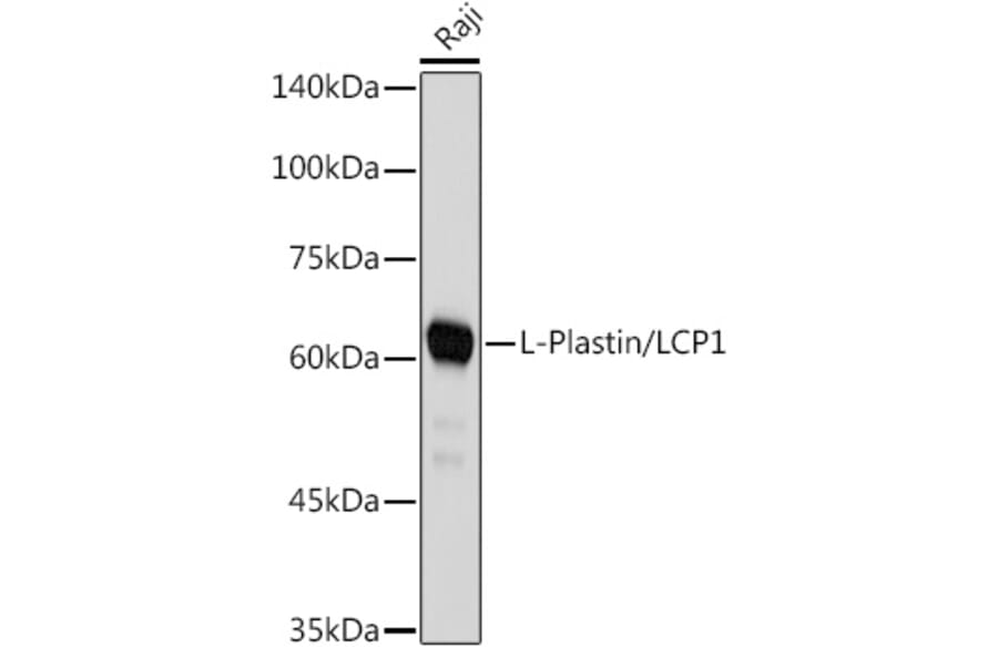 Western Blot - Anti-Plastin L Antibody [ARC2689] (A308929) - Antibodies.com