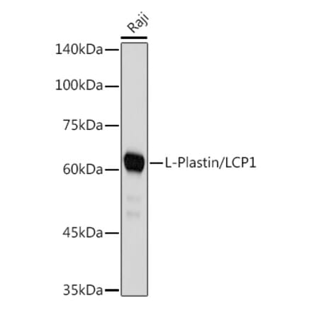 Western Blot - Anti-Plastin L Antibody [ARC2689] (A308929) - Antibodies.com