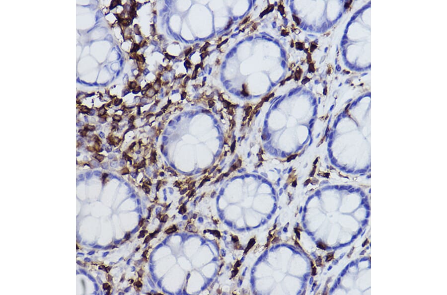 Immunohistochemistry - Anti-Plastin L Antibody [ARC2689] (A308929) - Antibodies.com
