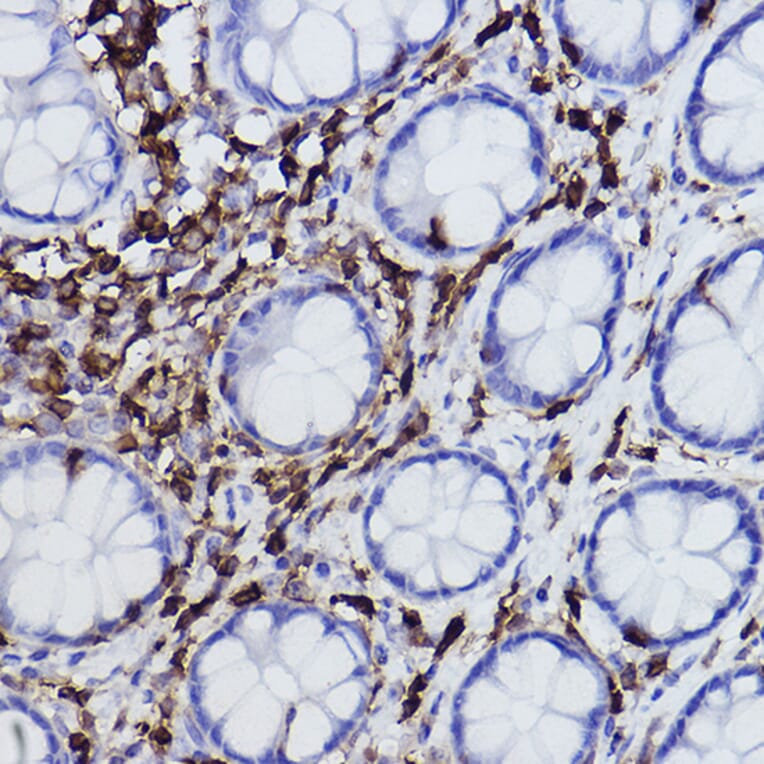 Immunohistochemistry - Anti-Plastin L Antibody [ARC2689] (A308929) - Antibodies.com