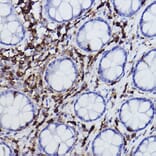 Immunohistochemistry - Anti-Plastin L Antibody [ARC2689] (A308929) - Antibodies.com