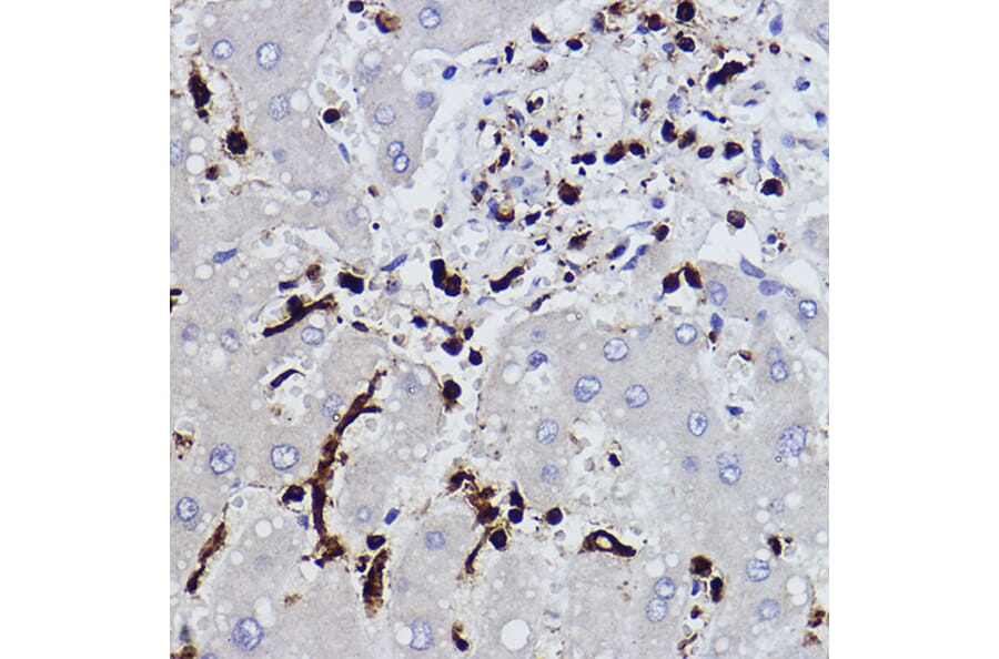 Immunohistochemistry - Anti-Plastin L Antibody [ARC2689] (A308929) - Antibodies.com