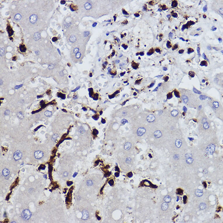 Immunohistochemistry - Anti-Plastin L Antibody [ARC2689] (A308929) - Antibodies.com
