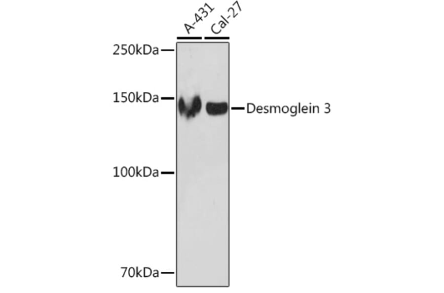 Western Blot - Anti-Desmoglein 3/PVA Antibody [ARC1190] (A308930) - Antibodies.com