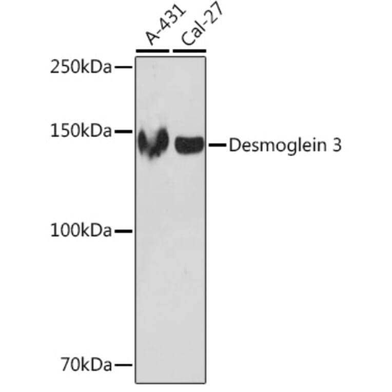 Western Blot - Anti-Desmoglein 3/PVA Antibody [ARC1190] (A308930) - Antibodies.com