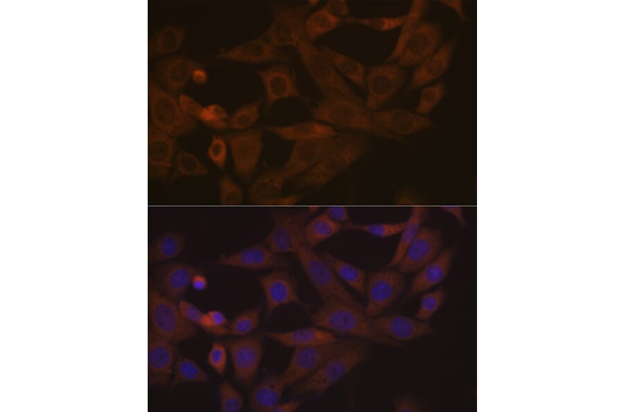 Immunofluorescence - Anti-Desmoglein 3/PVA Antibody [ARC1190] (A308930) - Antibodies.com