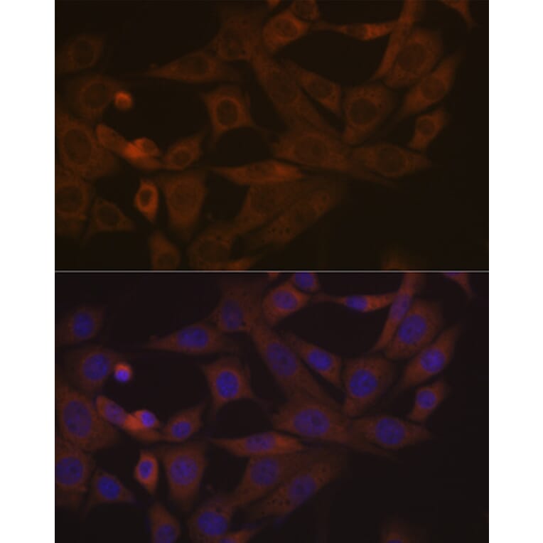 Immunofluorescence - Anti-Desmoglein 3/PVA Antibody [ARC1190] (A308930) - Antibodies.com
