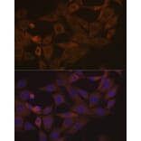 Immunofluorescence - Anti-Desmoglein 3/PVA Antibody [ARC1190] (A308930) - Antibodies.com