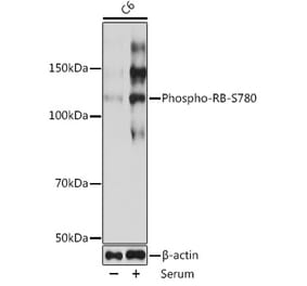Western Blot - Anti-Rb (phospho Ser780) Antibody [ARC0096] (A308931) - Antibodies.com