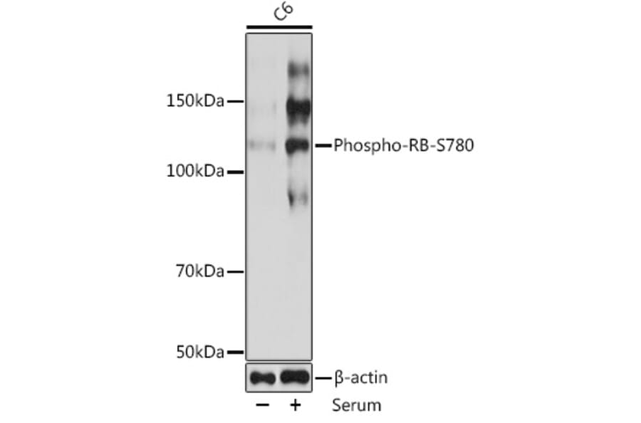 Western Blot - Anti-Rb (phospho Ser780) Antibody [ARC0096] (A308931) - Antibodies.com
