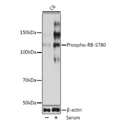 Western Blot - Anti-Rb (phospho Ser780) Antibody [ARC0096] (A308931) - Antibodies.com