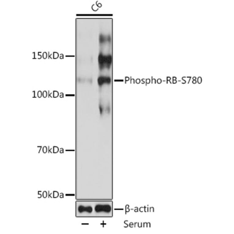 Western Blot - Anti-Rb (phospho Ser780) Antibody [ARC0096] (A308931) - Antibodies.com