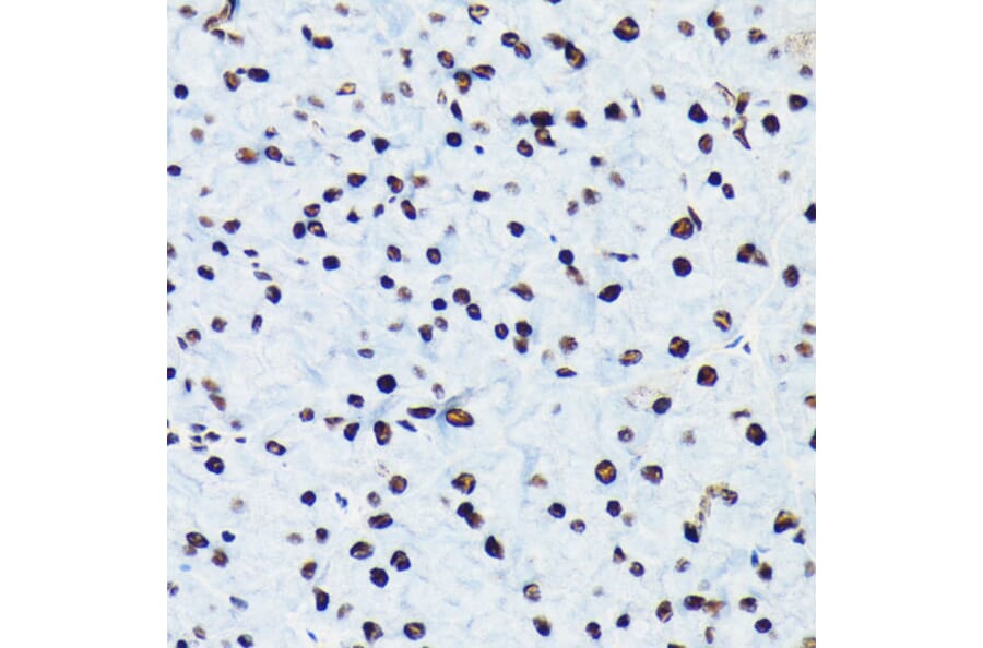 Immunohistochemistry - Anti-Rb (phospho Ser780) Antibody [ARC0096] (A308931) - Antibodies.com
