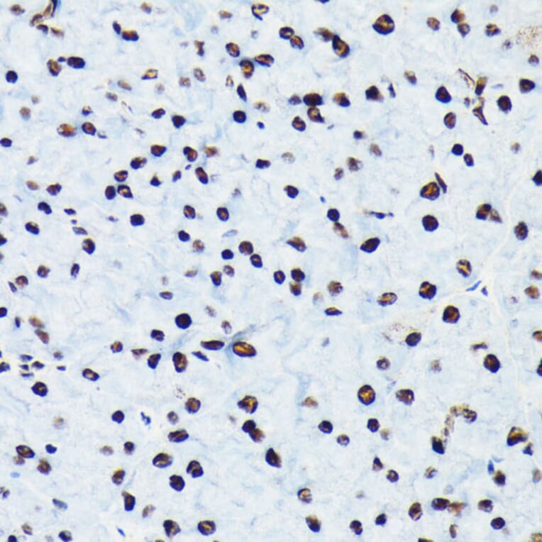 Immunohistochemistry - Anti-Rb (phospho Ser780) Antibody [ARC0096] (A308931) - Antibodies.com