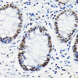 Immunohistochemistry - Anti-Rb (phospho Ser780) Antibody [ARC0096] (A308931) - Antibodies.com
