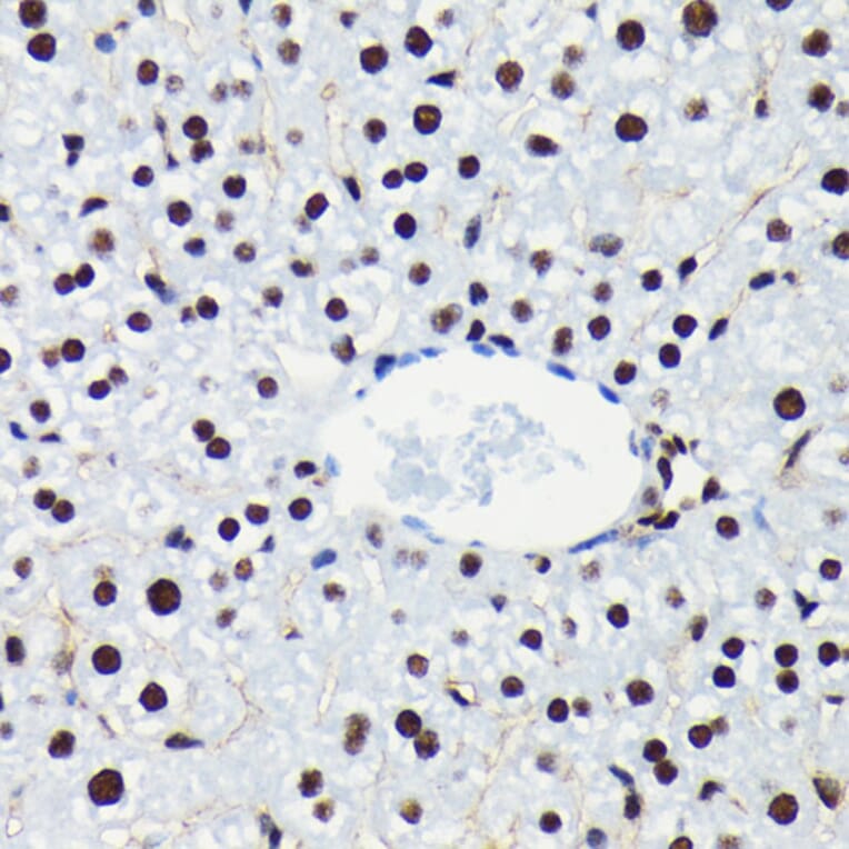 Immunohistochemistry - Anti-Rb (phospho Ser780) Antibody [ARC0096] (A308931) - Antibodies.com
