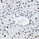 Immunohistochemistry - Anti-Rb (phospho Ser780) Antibody [ARC0096] (A308931) - Antibodies.com